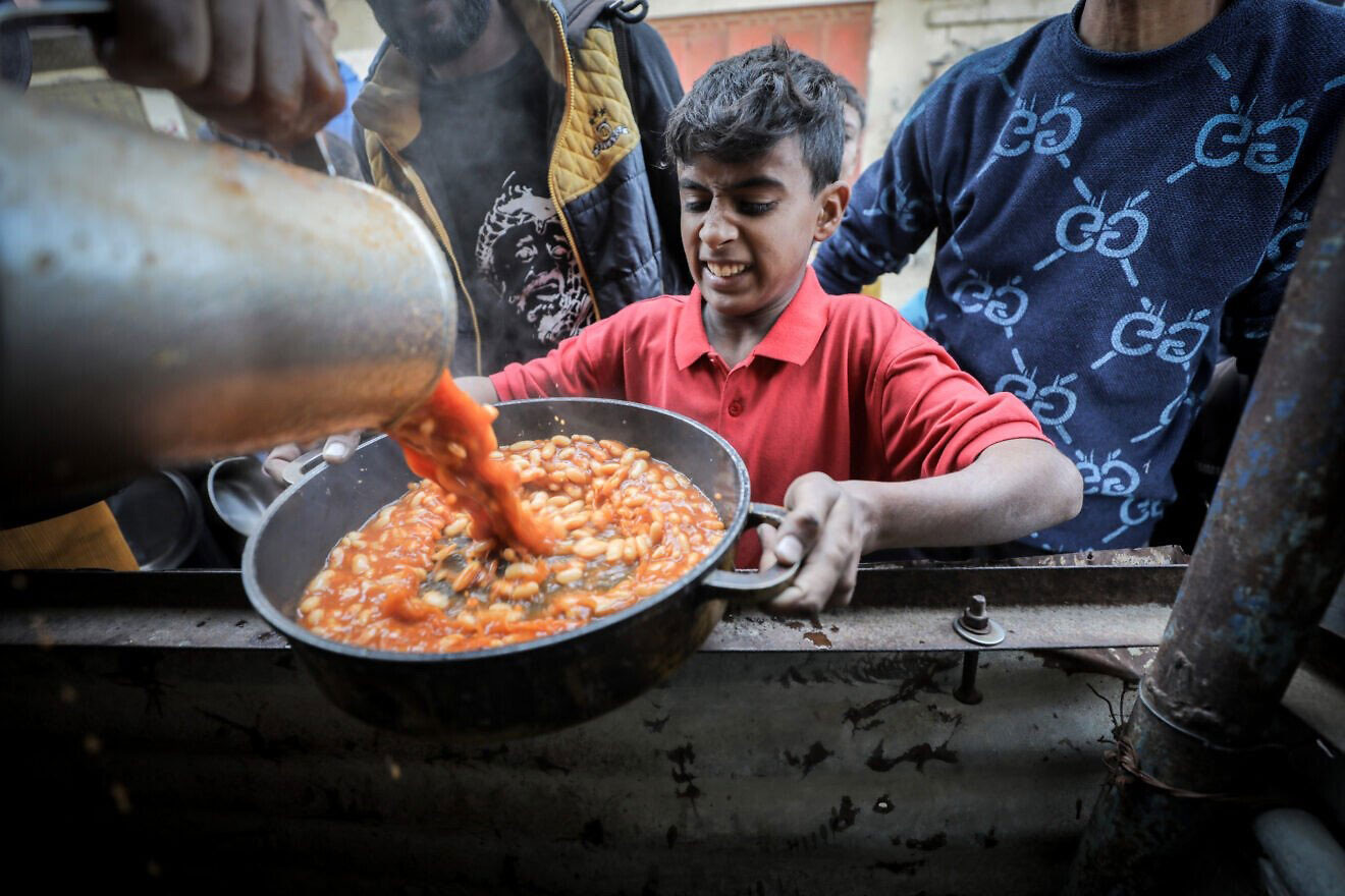 Gaza ‘starvation’ poster child has genetic condition, left Strip with Israel’s help